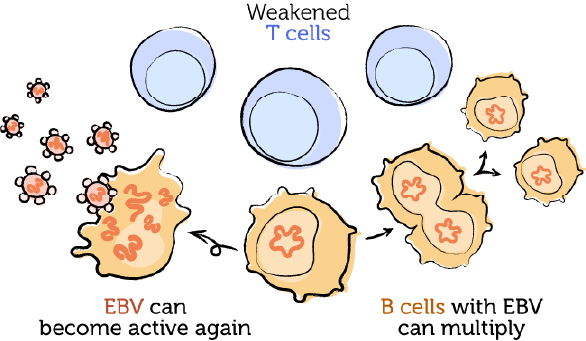 The weakened immune system, EBV, and PTLD 3