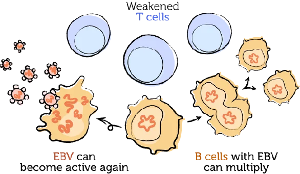 The weakened immune system, EBV, and PTLD 3