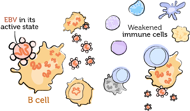 The weakened immune system, EBV, and PTLD 4