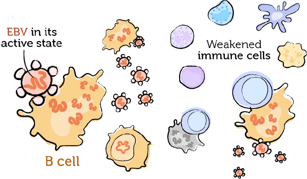 The weakened immune system, EBV, and PTLD 4