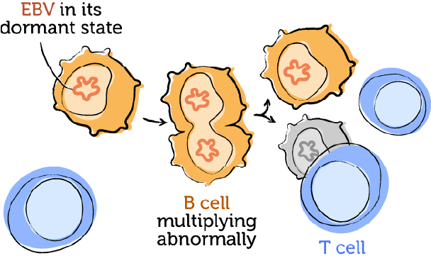 The working immune system and EBV 4
