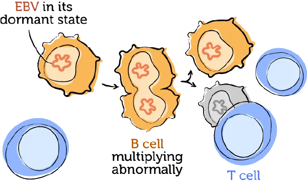 The working immune system and EBV 4