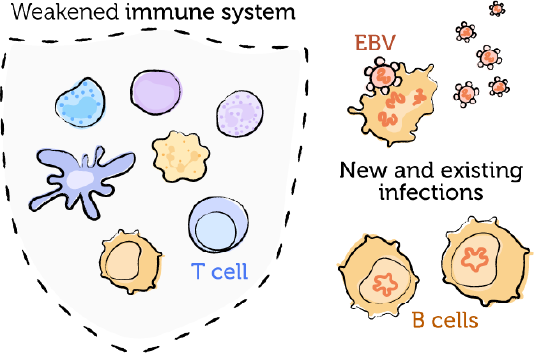 The weakened immune system, EBV, and PTLD 2