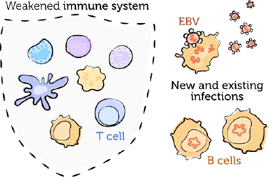 The weakened immune system, EBV, and PTLD 2